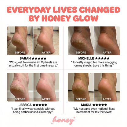 HoneyGlow™ – Foot Beauty Kit