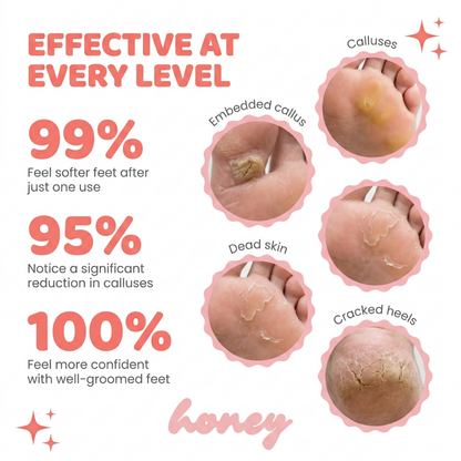 HoneyGlow™ – Foot Beauty Kit